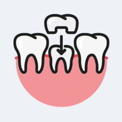 Dental Crowns