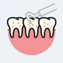 Dental Scale