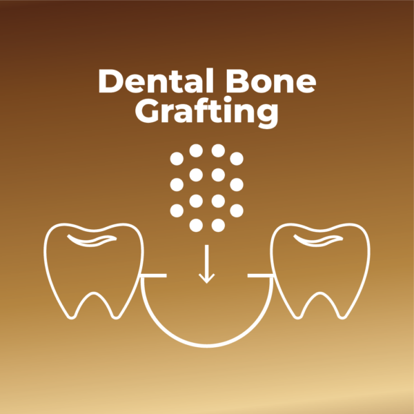 Dental Bone Grafting