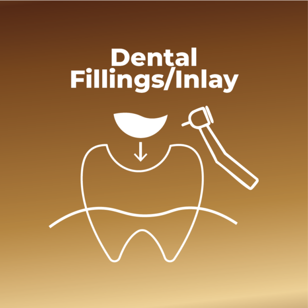 Dental Inlay/ Filling