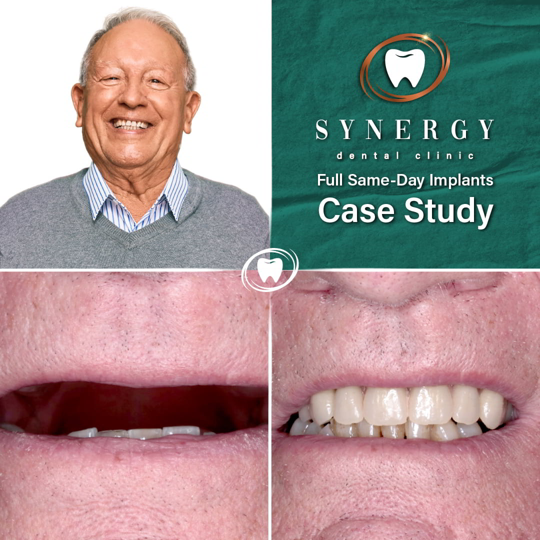 Before and After Case Study Frame - FSDI 7 EN