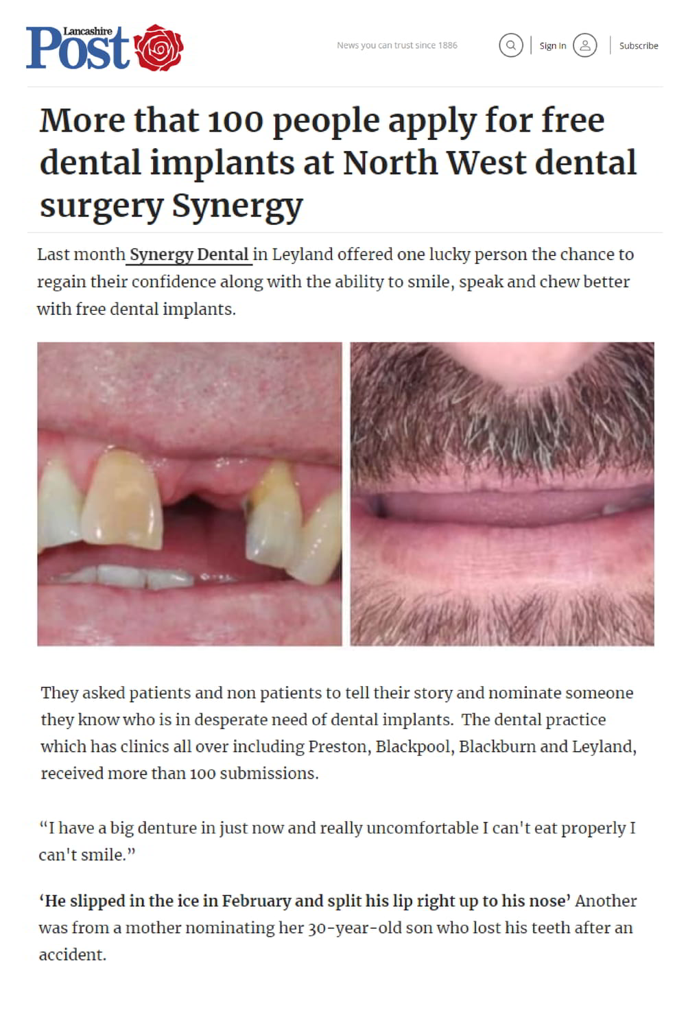 Synergy Dental Free implant treatment