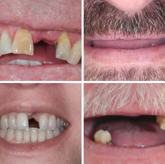 More than 100 people have submitted pictures of their teeth, or lack of, in the hope of getting a new set for free.
